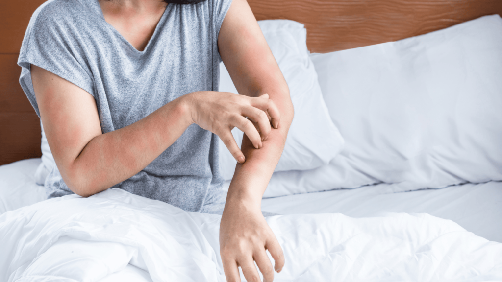 persona en la cama rascándose el brazo por alergia al sol